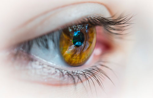 ¿Problemas de visión? ¿No será un glaucoma?